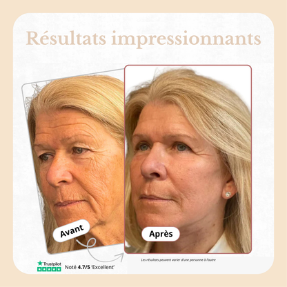 BAUME AU CALCIUM REPULPANT