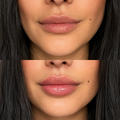 Hyaluronic Acid Lip Plumper
